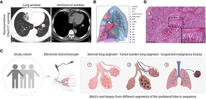 Alterations of lower respiratory tract microbiome and short-chain fatty acids in different segments in lung cancer: a multiomics analysis